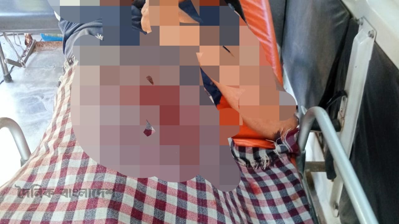 বীরগঞ্জে জমি বিরোধের জেরে কর্মচারীকে কুপিয়ে জখম, থানায় মামলা দায়ের