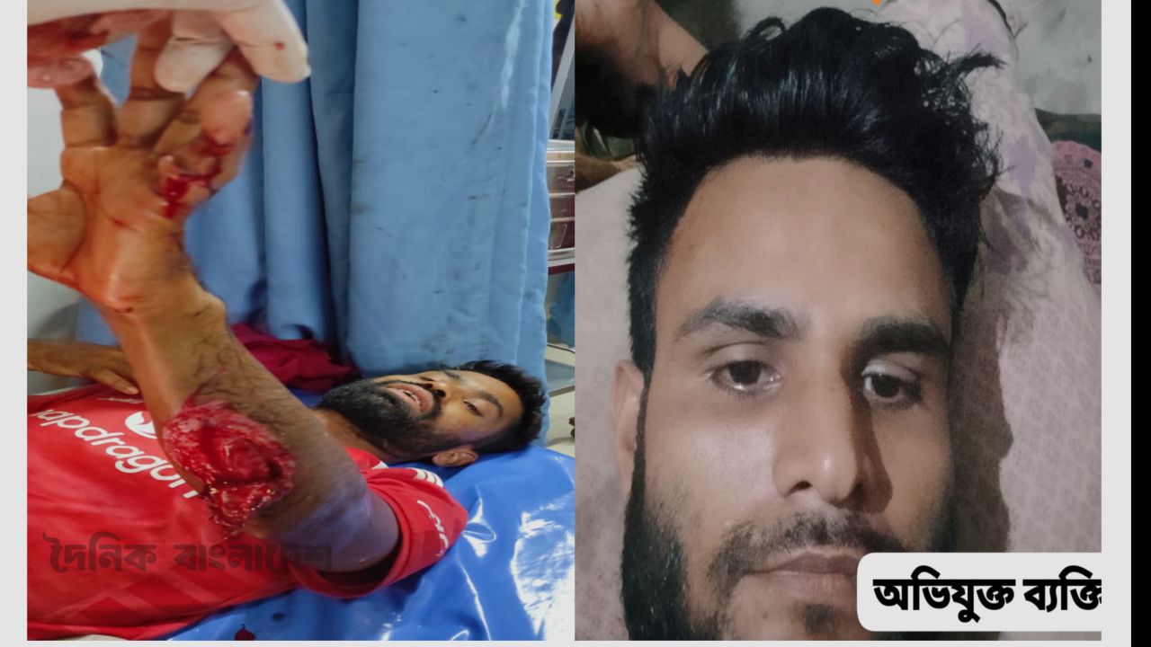 দরগাহ চরপাড়া এলাকায় কন্টাক্ট কিলারের হাতে হামলার শিকার আনছারুল্লাহ নামে এক যুবক
