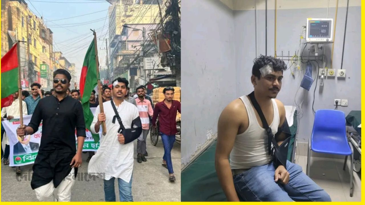 ঘাত-প্রতিঘাত থামাতে পারেনি আজিজ রুবেলকে ব্যান্ডেজ হাতে সমাবেশে অংশগ্রহণ